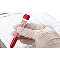 ����� ������ ����� (CBC/Diff - 5 ������� ����������)